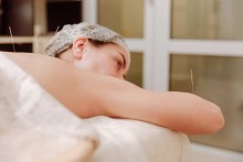 Femme en séance d'acupuncture