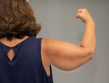 Comment améliorer sa condition physique malgré l'obésité ? 
