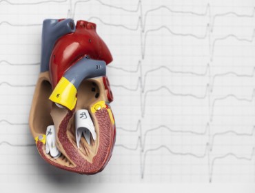 Prévention Primaire des Maladies Cardiovasculaires : Une Réflexion Basée sur une Expérience Personnelle et le Rôle Clé du Coro Scanner